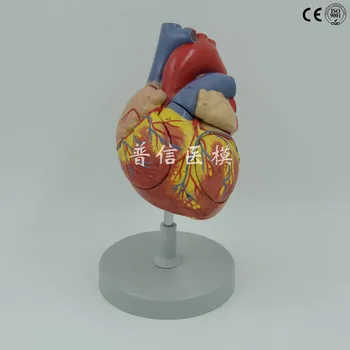 Human heart anatomical model enlarged ventricle model Medical Science teaching supplies