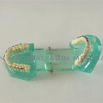 Orthodontists model With metal & ceramic brackets Irregular tooth Ortho Metal dentist patient student learning model