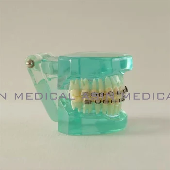 Orthodontists model With metal & ceramic brackets Irregular tooth Ortho Metal dentist patient student learning model