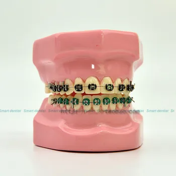 2016 Orthodontic correction model Dental Teaching model