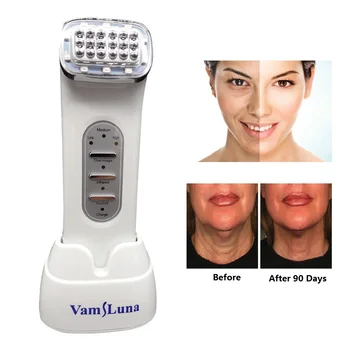 Thermage Facial RF Radio Frequency For Lifting Face, Lift Body SKin, Wrinkle Removal, Skin Tightening Beauty Care