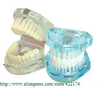 Natural size model (HH) dental tooth teeth dentist dentistry anatomical anatomy model odontologia