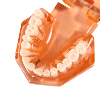 Dental Disease Removable Study Teaching Teeth Model Stand Teeth Moldel Orange Color