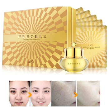 Strong Effects Powerful Whitening Freckle Cream Remove Melasma Acne Spots Pigment Melanin Face Care Cream Anti Wrinkle Aging
