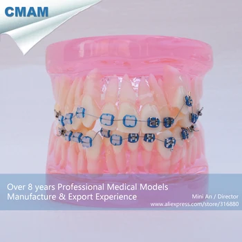 CMAM-DH205-2 Transparent Ortho Metal&Ceramic Tooth Dental Model, ORT series Jaw Model for Training of Dentistry