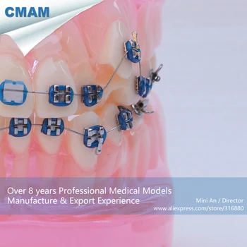 CMAM-DH205-2 Transparent Ortho Metal&Ceramic Tooth Dental Model, ORT series Jaw Model for Training of Dentistry