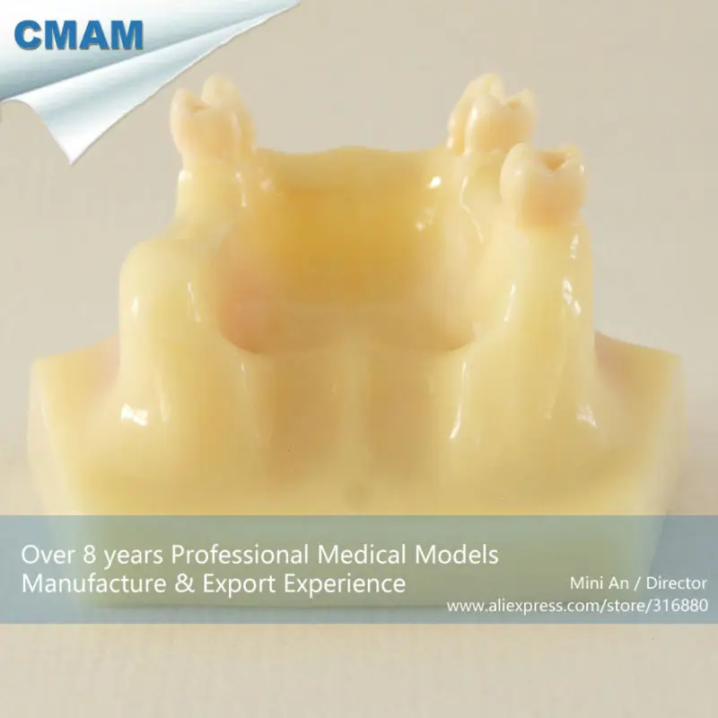 CMAM-DH2005 Toothless Jaw Maxilla Model, Sinus Lifting Model for Student Practice