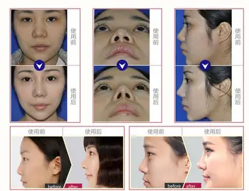 Nose Up Shaping Shaper Lifting Bridge Straightening Beauty Nose Clip Nose Shaper
